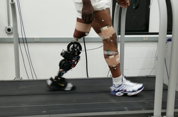 AI-Powered Prosthetic Breakthrough: Revolutionizing Assistive Technology in 2025